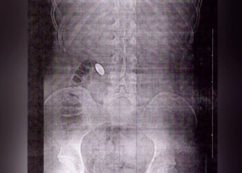 Homem é indiciado por estupro virtual e extorsão contra amigo; ele obrigou a vítima engolir uma moeda