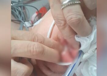 Familiares encontram larvas na boca e nariz de idosa internada em UTI de hospital universitário