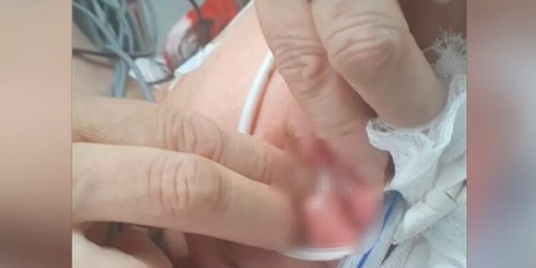 Familiares encontram larvas na boca e nariz de idosa internada em UTI de hospital universitário