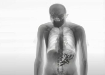 Detentos voltam da saída temporária de Natal com celulares escondidos no estômago e no ânus