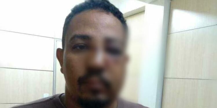 Cartomante é espancado após cliente não gostar as previsões feitas por ele