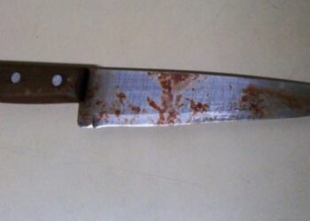 IMAGEM FORTE – Mulher decepa pênis do marido durante briga por ciúmes no AM