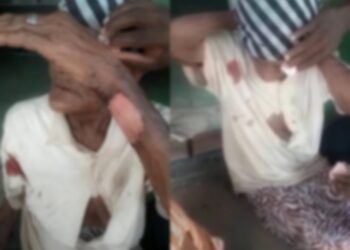 Idosa de 103 anos é brutalmente agredida durante assalto em sítio