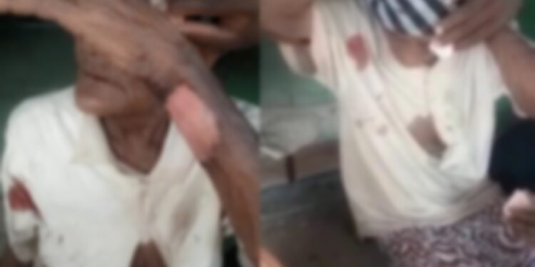 Idosa de 103 anos é brutalmente agredida durante assalto em sítio