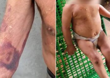 Casal é acusado de bater no filho, um bebê doente de câncer, e maltratar idosos  