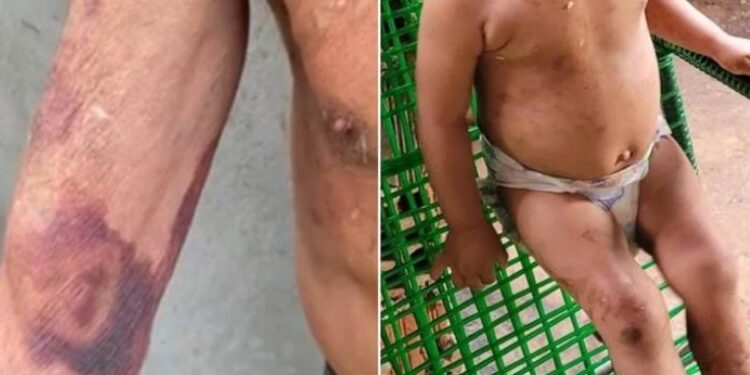Casal é acusado de bater no filho, um bebê doente de câncer, e maltratar idosos  
