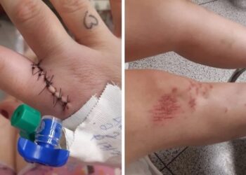 IMAGENS FORTES: homem amarra namorada no engate do carro e arrasta para a morte