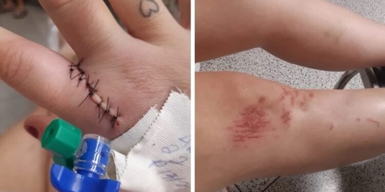 IMAGENS FORTES: homem amarra namorada no engate do carro e arrasta para a morte