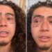 Whindersson Nunes mostra olhos vermelhos após luta com Popó e brinca: “Ele passou conjuntivite”