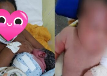 Família acusa hospital de fraturar braço de bebê durante parto no interior do AM