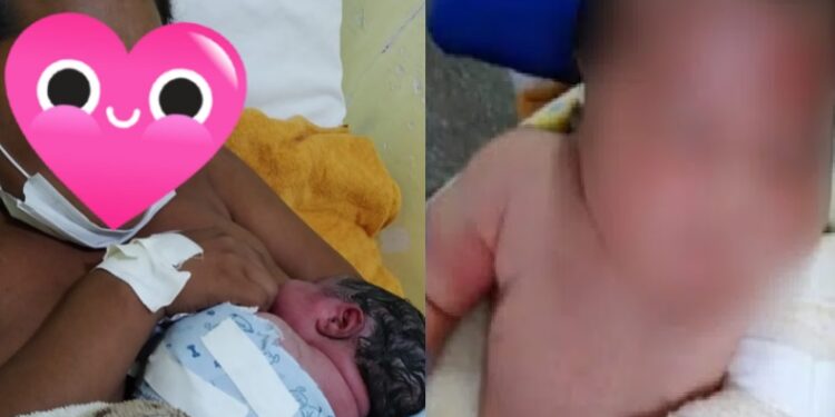 Família acusa hospital de fraturar braço de bebê durante parto no interior do AM