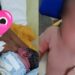 Família acusa hospital de fraturar braço de bebê durante parto no interior do AM