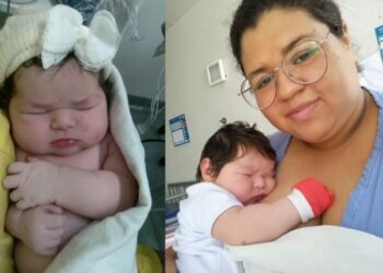 Mulher descobre que estava grávida na hora do parto: “Achava que era pedras nos rins”