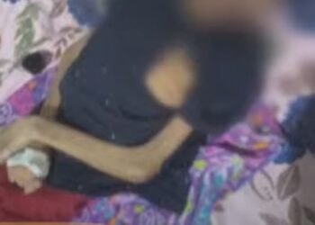 Adolescente resgatado de situação de maus-tratos está internado na UTI