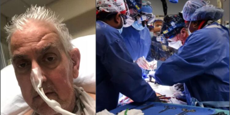 Morre primeiro homem a receber transplante de coração de porco