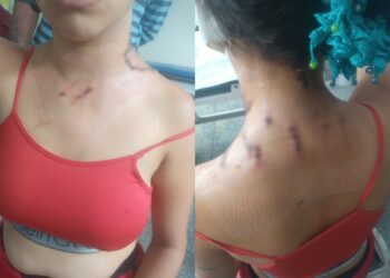 Mulher é esfaqueada pelo marido ao defender sogra durante briga