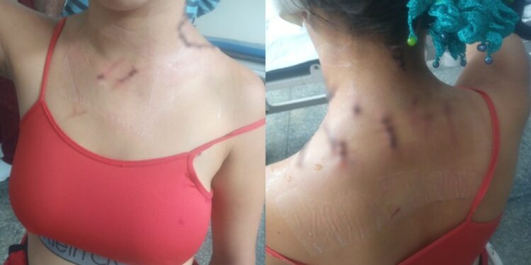 Mulher é esfaqueada pelo marido ao defender sogra durante briga