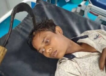 NASCEU DE NOVO! Adolescente cai da cama e fica com foice cravada na cabeça