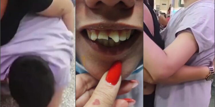 Mãe e filho autista são desrespeitados por funcionários da Latam, criança entra em crise e quebra o dente ao cair no chão