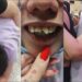 Mãe e filho autista são desrespeitados por funcionários da Latam, criança entra em crise e quebra o dente ao cair no chão