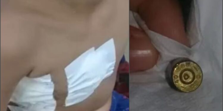 Mãe do menino baleado no Novo Aleixo afirma que o tiro foi feito por um policial: “o senhor atirou no meu filho”
