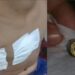 Mãe do menino baleado no Novo Aleixo afirma que o tiro foi feito por um policial: “o senhor atirou no meu filho”