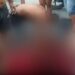 Homem é baleado na cabeça por motoqueiro, na zona Leste de Manaus