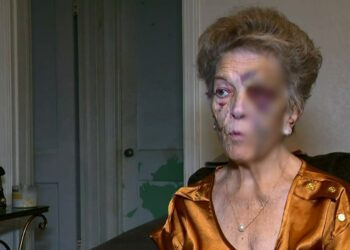 Bateu, morreu: Após espancar idosa, ladrão é ‘castigado’ e morre em acidente