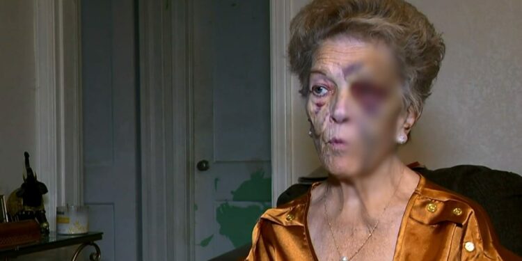 Bateu, morreu: Após espancar idosa, ladrão é ‘castigado’ e morre em acidente