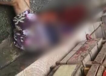 Cenas fortes: Jovem leva tiro na cabeça ao ser vítima de assalto na feira e ‘aceita Jesus’