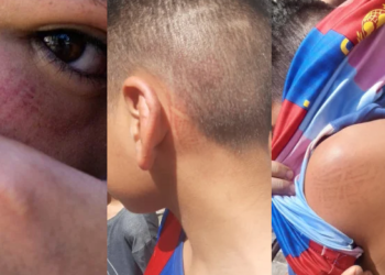 Vídeo: ‘Ele é um monstro’, diz garoto de 14 anos espancado por homem após assobio