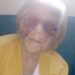 Idosa de 93 anos aparece com o rosto e olhos roxos e suspeita é a própria nora