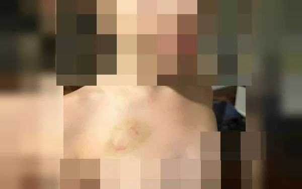 Advogado morde filha de 6 anos: ‘Queria morar só com a minha mãe’