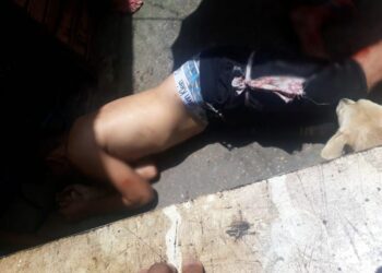 Assaltante leva tiro na perna ao ser surpreendido por policial à paisana durante roubo