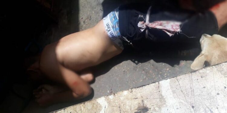Assaltante leva tiro na perna ao ser surpreendido por policial à paisana durante roubo