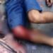 Homem fica encurralado no ‘Beco da Morte’, na Compensa, e morre com vários tiros