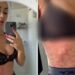 Ex-BBB choca ao mostrar inflamação pelo corpo e não ter diagnóstico do problema