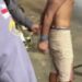 Jovem escapa do ‘vale da morte’ após ser sequestrado pelo tribunal do crime em Manaus