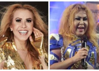 Joelma preocupa fãs ao fazer show com o rosto todo inchado