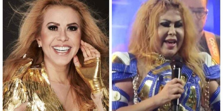Joelma preocupa fãs ao fazer show com o rosto todo inchado