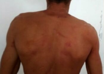 Marido pula muro de casa para fugir e não apanhar mais da esposa