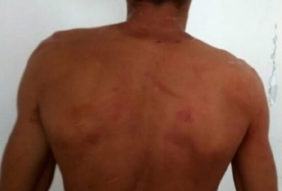 Marido pula muro de casa para fugir e não apanhar mais da esposa