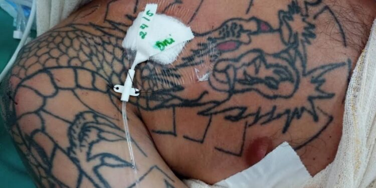 HPS João Lúcio procura familiares de paciente internado vítima de agressão