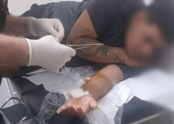 Jovem é baleado no bairro São Jorge após ter o celular roubado por ladrão