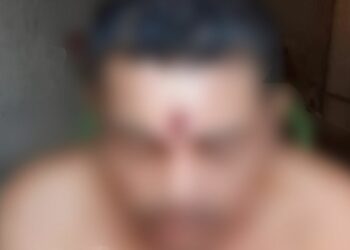 Homem cai de moto após levar tiro na testa, vai para casa dormir e é salvo pela mãe