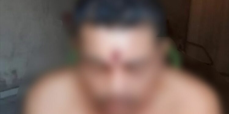 Homem cai de moto após levar tiro na testa, vai para casa dormir e é salvo pela mãe