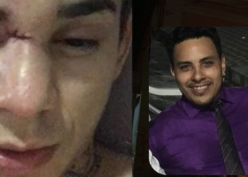 Conhecido por dar problemas nos bares, ‘brigão’ mete a porrada em baterista no Bar do Armando