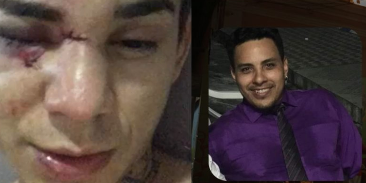 Conhecido por dar problemas nos bares, ‘brigão’ mete a porrada em baterista no Bar do Armando
