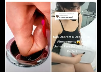 Mulher dá descarga com o dedo dobrado por causa da unha em gel e vai parar no hospital