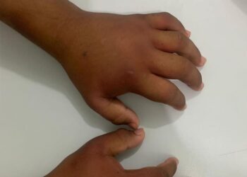 Maldade pura! Menino de 8 anos estava urinando sangue e com as mãos inchadas de tanta ‘ripada’